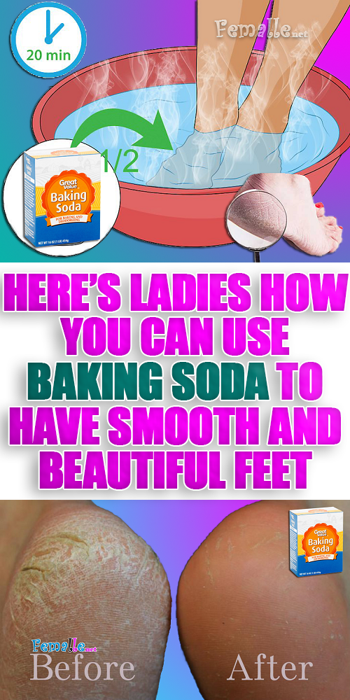 Here’s Ladies How You Can Use Baking Soda to Have Smooth and Beautiful Feet