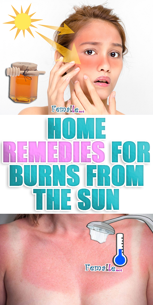 7 Home Remedies for sunburnt