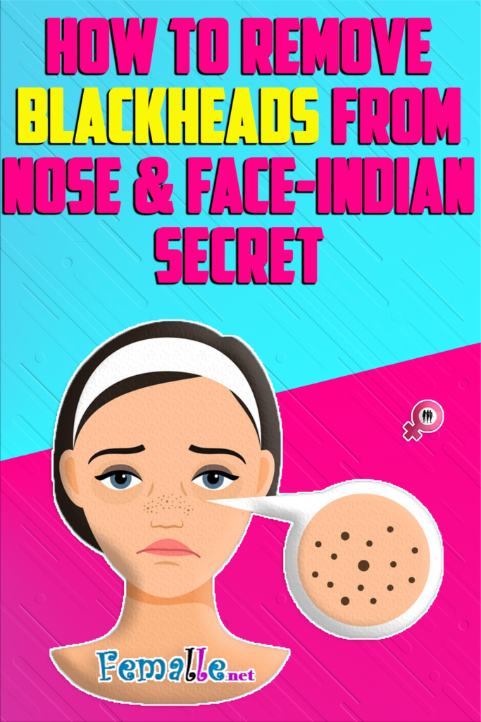 How to Remove Blackheads from Nose & Face-Indian Secret
