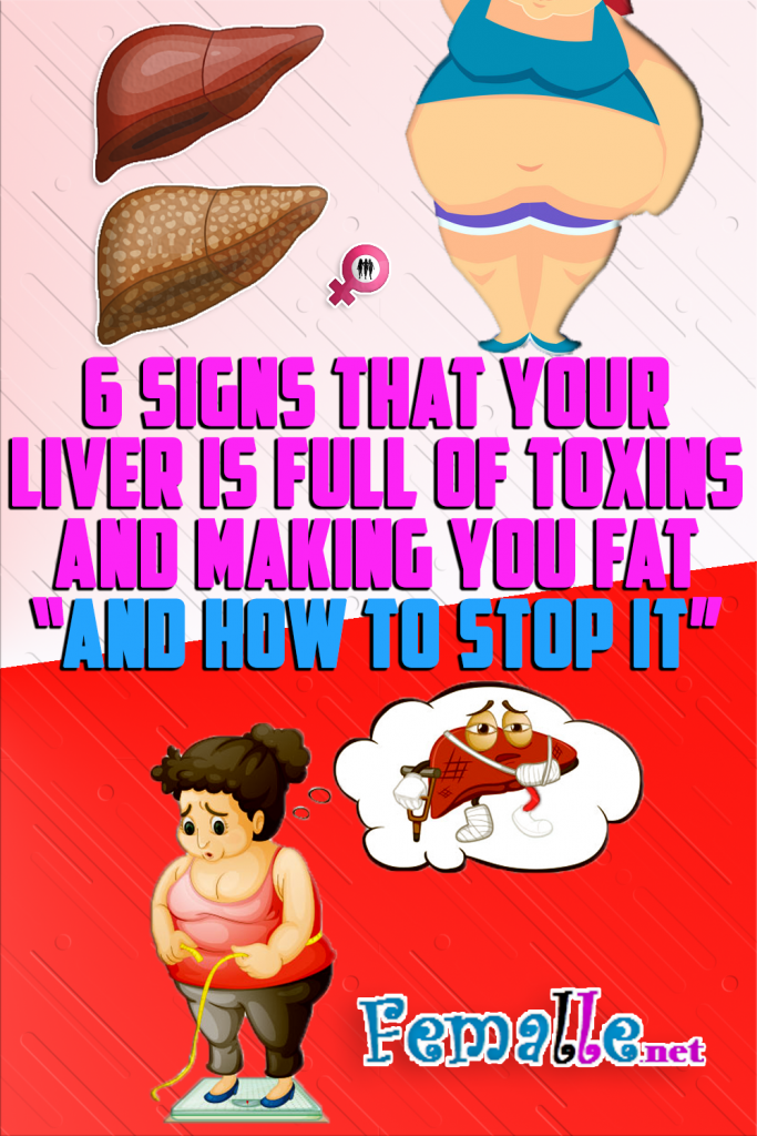 6 Signs That Your Liver Is Full Of Toxins And Making You Fat “And How To Stop It”