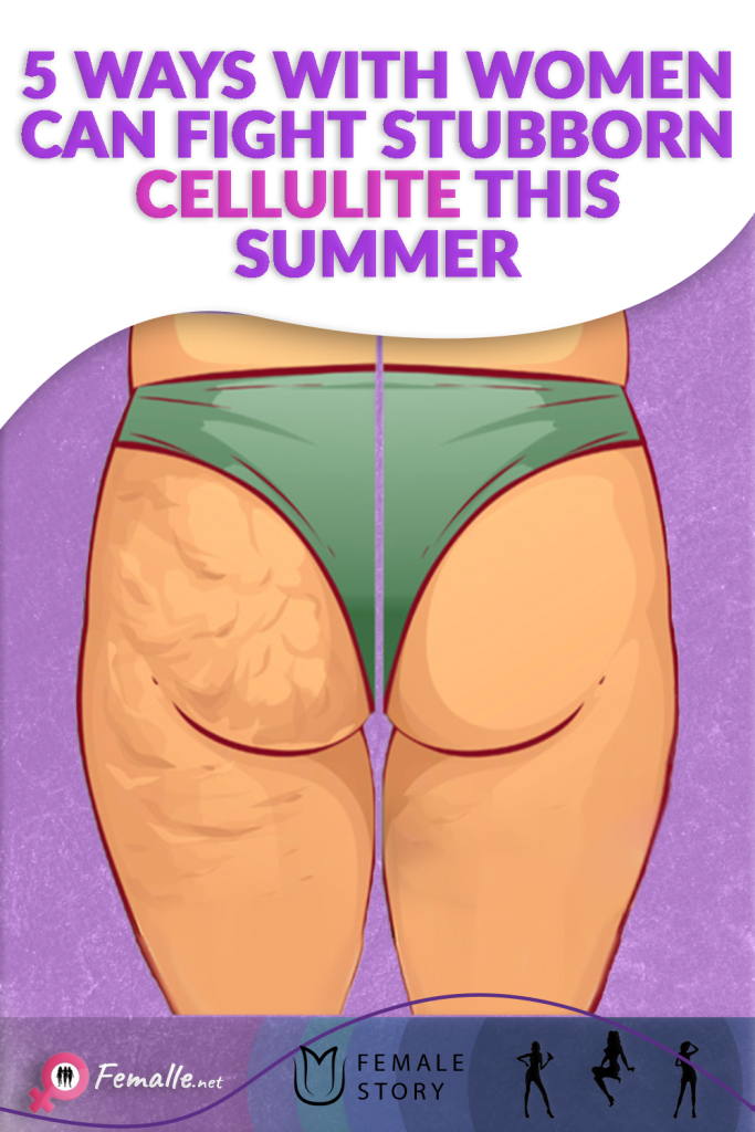 5 Ways with Women Can Fight Stubborn Cellulite This Summer