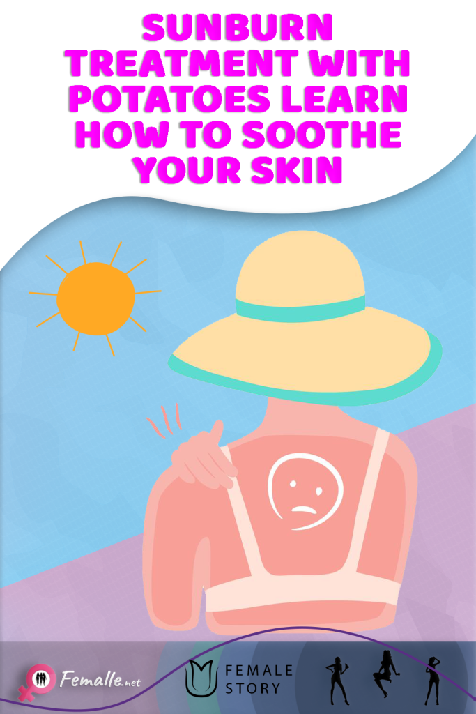 Sunburn Treatment with Potatoes Learn How to Soothe Your Skin